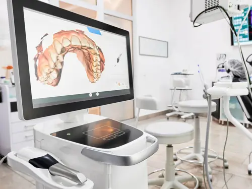 CEREC Digital Scanner & MIll in Eugene & Florence, OR
